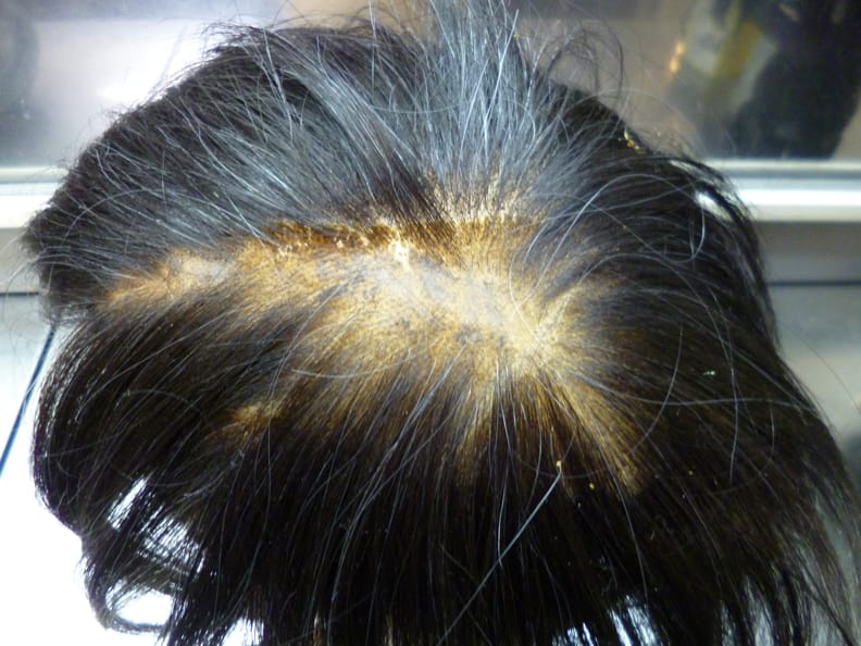 テープ台交換 Before